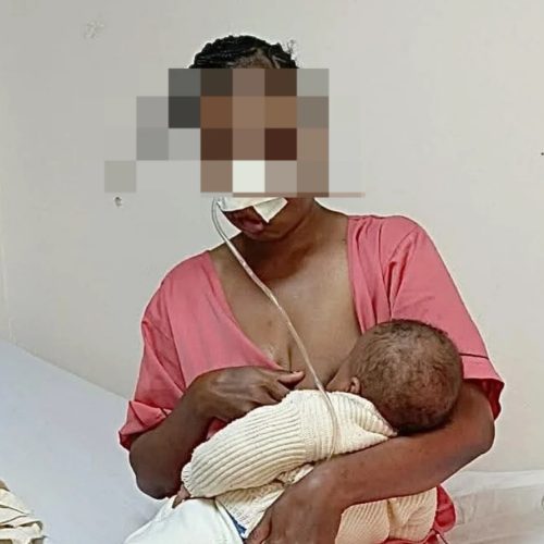 Mulher de 29 anos perde a visão no olho esquerdo após violência do marido