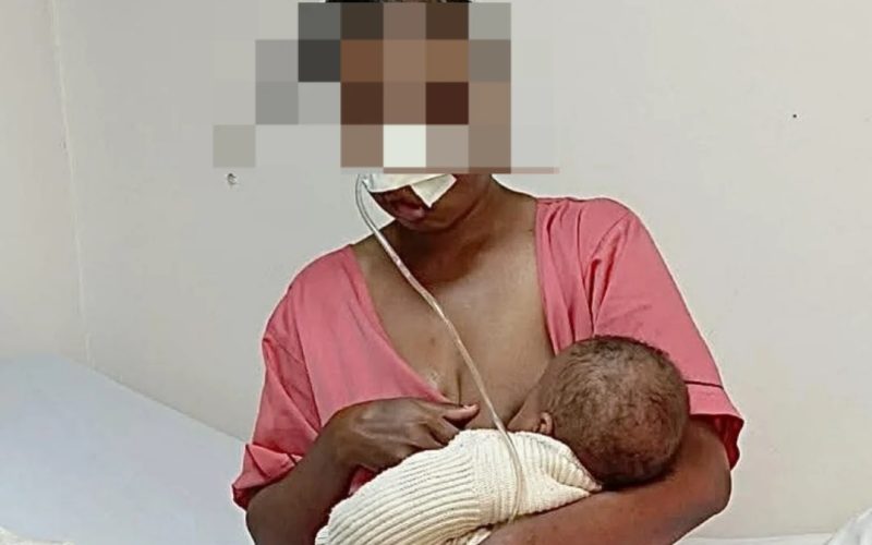 Mulher de 29 anos perde a visão no olho esquerdo após violência do marido