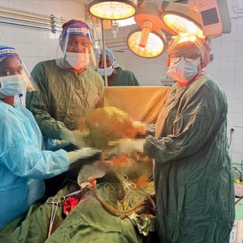 Hospital Central de Nampula realiza operação bem-sucedida e retira tumor de 20 quilos