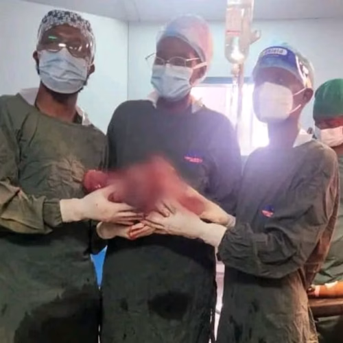 Equipa médica remove quisto gigante do ovário em intervenção bem-sucedida