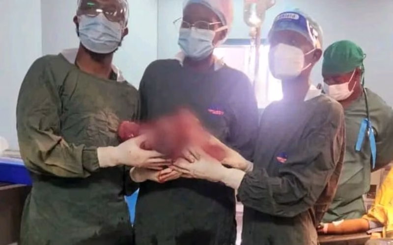 Equipa médica remove quisto gigante do ovário em intervenção bem-sucedida